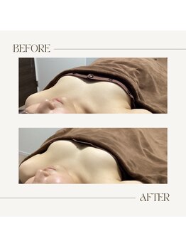 ラグレ(LUXRE)/バストケア