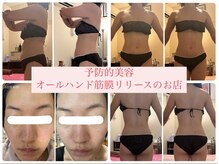 トゥインクルボーテ(Twinkle beaute)