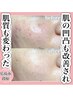 《再来》ニキビ・ボコボコ肌・シミケアAirプラズマ
