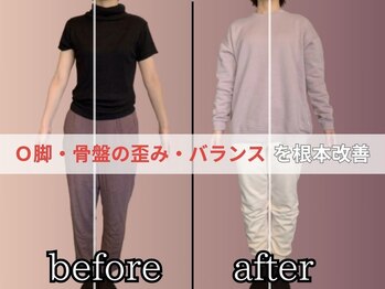 リベスト(RE:BEST)/O脚・骨盤の歪み・バランス改善