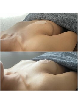 モア(moa)/産後ママ、ハリUP