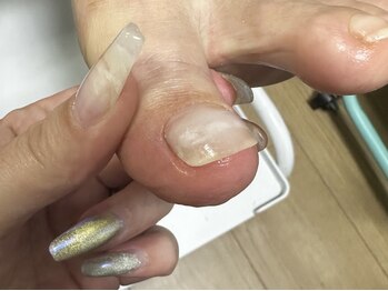 さあちゃん式フットケア アンド 巻き爪 ハンドケア アンド 深爪専門店の写真/初めての方も◎足の巻き爪・手の深爪・トラブル爪も美しく変わる!専門サロンであなたの爪を輝かせませんか?