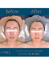 スー(Sue)/月2回フェイシャルケア