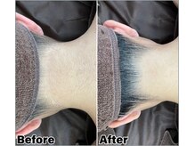 ベルミーランド マルエツ安行慈林の雰囲気（えり足脱毛施術前→施術後）