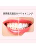 【自分史上最高コース】スペシャルホワイトニング12回チケット（６分×６回）