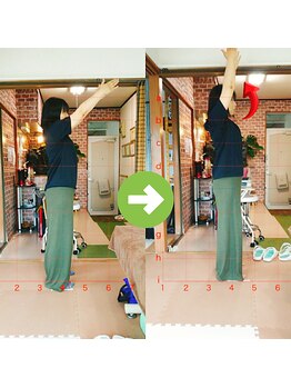 サプライズ整体院/40代ママさんの肩こり初回結果