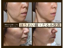 エボルブ 四条烏丸店(EVOLVE)