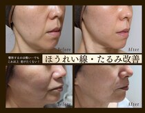 エボルブ 四条烏丸店(EVOLVE)