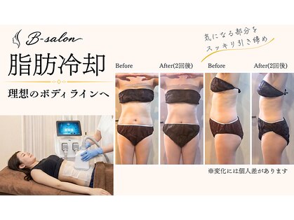 ビーサロン(B-salon)の写真