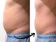 キュアフロウ 新潟巻の写真/【40代からの体型変化に待ったなし！】今までと違う根本ケアでたるみ脂肪解消◎本気で身体を変えたい方に
