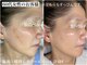 コマ(KOMA)の写真