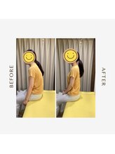 多摩 唐木田整体室/猫背・巻き肩のビフォーアフター