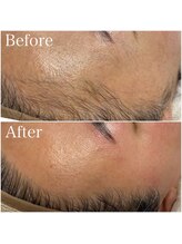 ロリー(LOLiE)/フェイシャルwax