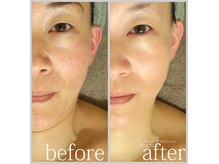 アン グレーヌ 自由が丘(unegraine)/ノーファンデに自信が持てる！