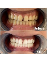 ライトビューティー 池袋店(LightBeauty)/症例写真