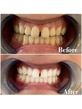 ライトビューティー 池袋店(LightBeauty)/症例写真