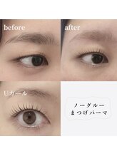 ハッチ(hacchi)/Dカール