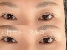 ハナ(87)/お目元トータルコース