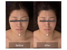 レーヴリゼ(Revelise)/頭蓋骨小顔矯正＋整顔マッサージ