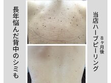 しっかりとカウンセリングさせて頂きます。