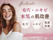 オーキッド(ORCHID)