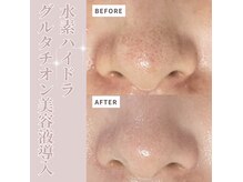 ベル(Belle)の雰囲気（角栓・黒ずみ一つ残さない丁寧な施術ならお任せ下さい！）