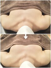 エクスター(EXTR)/マシュマロバストケア