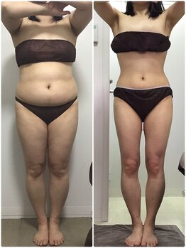 ビューティーワークスシャンティ 柏店(Beauty Works Shanti)/－25キロ！！目標達成☆