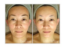 アン グレーヌ 自由が丘(unegraine)/骨格調整でコンパクトフェイス！