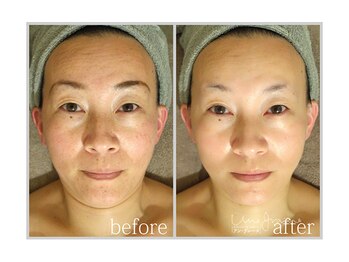 アン グレーヌ 自由が丘(unegraine)/骨格調整でコンパクトフェイス！