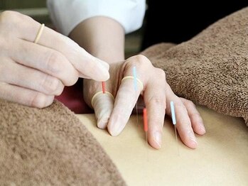 トイトイトイ(toitoitoi)の写真/【女性鍼灸師による女性のためのお悩み解消サロン】冷え/むくみ/妊活/自律神経の乱れetc…鍼灸で根本改善＊