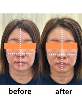 うらら整骨院/小顔矯正でむくみケア！