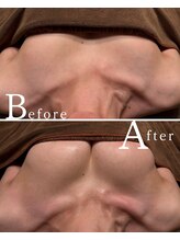 ロココ 水戸店(Rococo)/バストアップBefore &nbsp;After