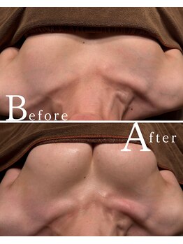 ロココ 水戸店(Rococo)/バストアップBefore After