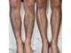 シャイニースキン(Shiny skin)の写真