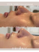 ミミルーチェ(mimiluce)/タラソプレハーブピーリング◎