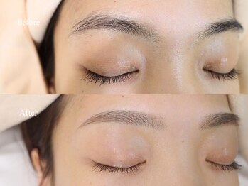 エンカシェット 代官山(En’e cachette)/【矯正美眉】毎朝のメイクも楽♪