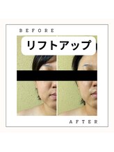 ニコノ(Nicono)/ふんわり上がる、若見え小顔