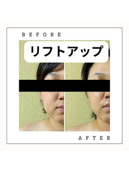 ニコノ(Nicono)/ふんわり上がる、若見え小顔