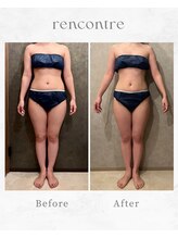 ランコント(rencontre)/肩こり/リンパ/ヘッドスパ/痩身