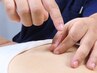 【二回目以降】痛みに徹底アプローチ★鍼灸整体60分 ¥24,750