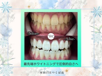 ホワイト つくば店(WHITE)/ビフォーアフター
