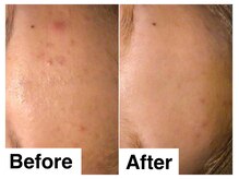 ナトゥーラ チュチュ(natura chuchu)/ナトゥーラ チュチュ梅田店/大阪