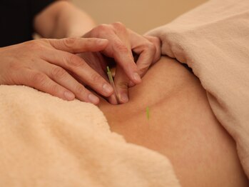 すやすや/京橋/都島/鍼灸/ヘッドスパ