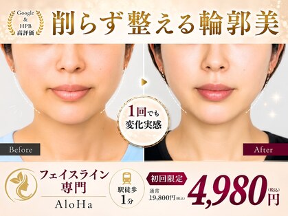 アロハ(ALOHA.)の写真