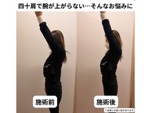 東岩槻ハレ整骨院(HALE)