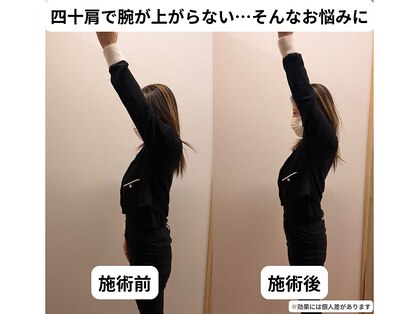 東岩槻ハレ整骨院(HALE)の写真