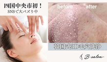 ビーサロン(B-salon)