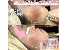 サロン(SALON)/復元パック＆ハーブピーリング
