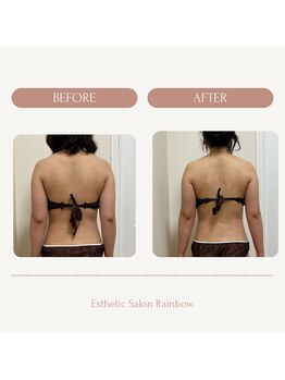 レインボー(Rainbow)/